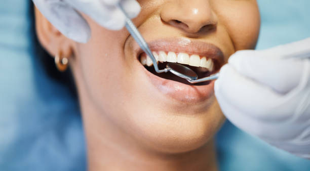 Best Emergency Dental Care for Broken or Chipped Teeth in Rocklin, CA